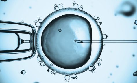 体外受精 IVF-ET